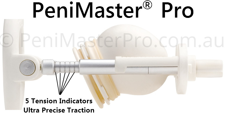 PeniMaster Tension Indicators